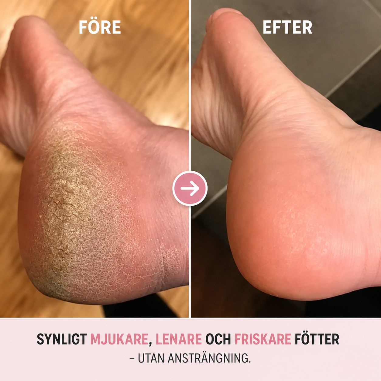 Serella™ PediCare Pro - Salongslena fötter hemma
