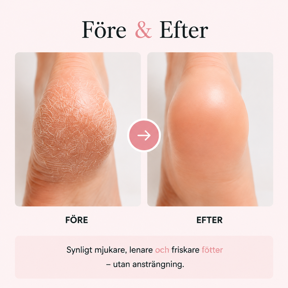 Serella™ PediCare Pro - Salongslena fötter hemma